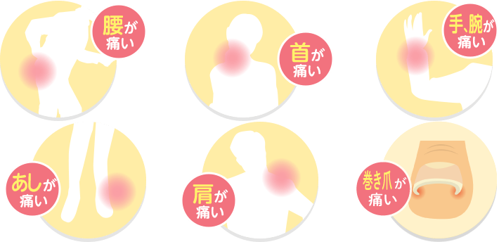 腰が痛い/首が痛い/手、腕が痛い/あしが痛い/肩が痛い