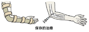 変形性肘関節症