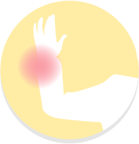 手・腕の疾患