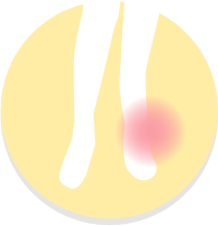 あし（股・膝・足）の疾患